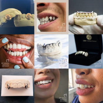 Grillz Collage