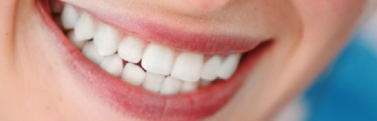 Wide Smile